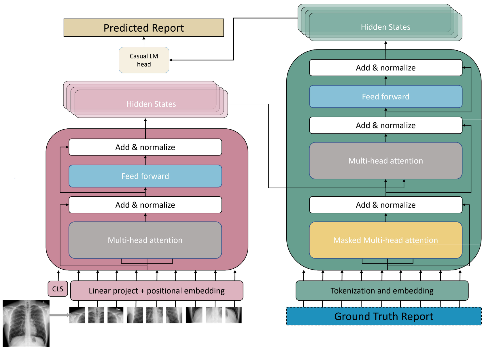 Radiology report generation using vision transformers and language models